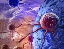 Malattie Oncologiche. La testimonianza di una donna forte di Albanella “Troppi casi, maggiore prevenzione”